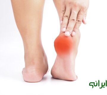 درمان خارپاشنه در طب سنتی