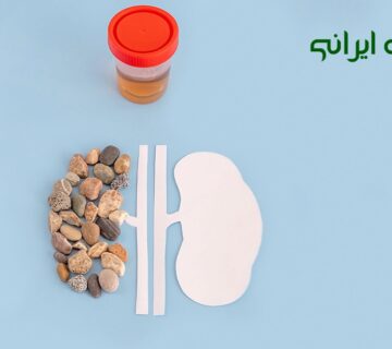 درمان سنگ کلیه در طب سنتی