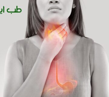 درمان اسید معده در طب سنتی