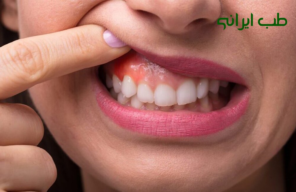 فواید گل بابونه