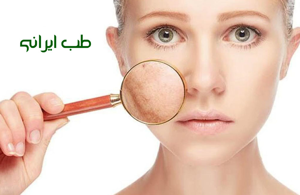 حجامت صورت برای رفع جوش
