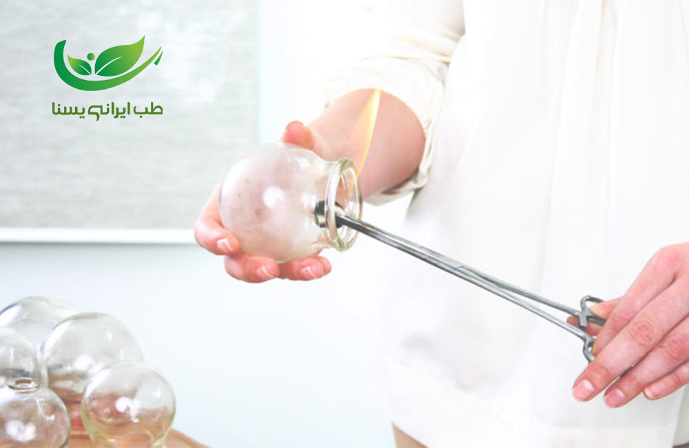 حجامت ساکرال برای نازایی