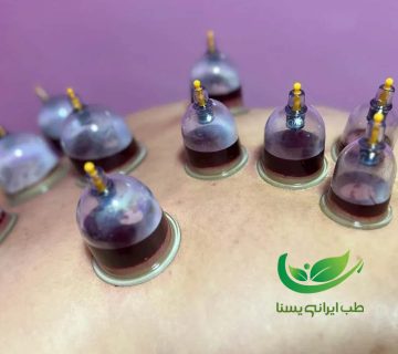 تقویم حجامت