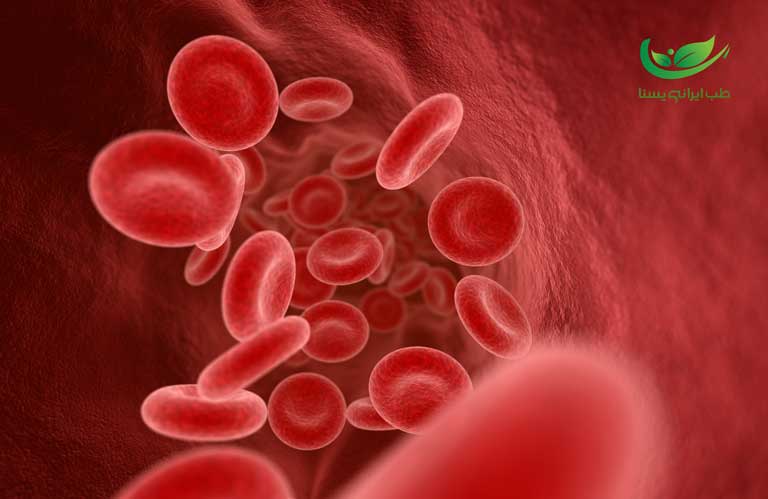 درمان غلطت خون با حجامت عام