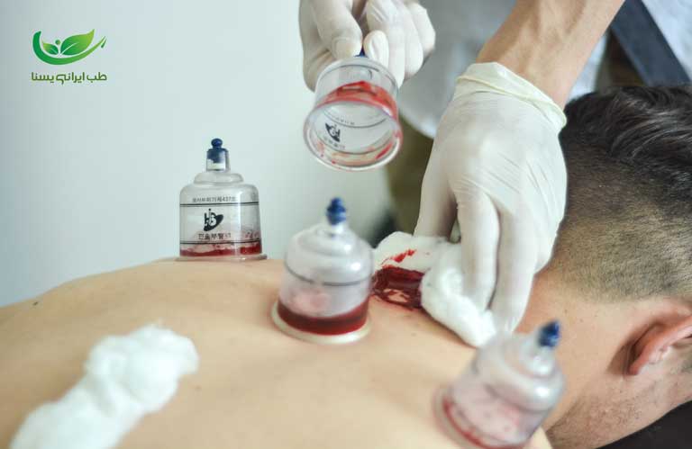 حجامت ماستوئید و تمپورال