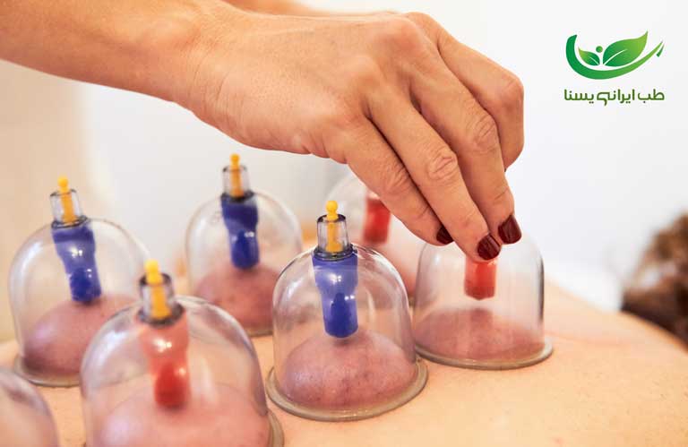 درمان حجامت با بواسیر