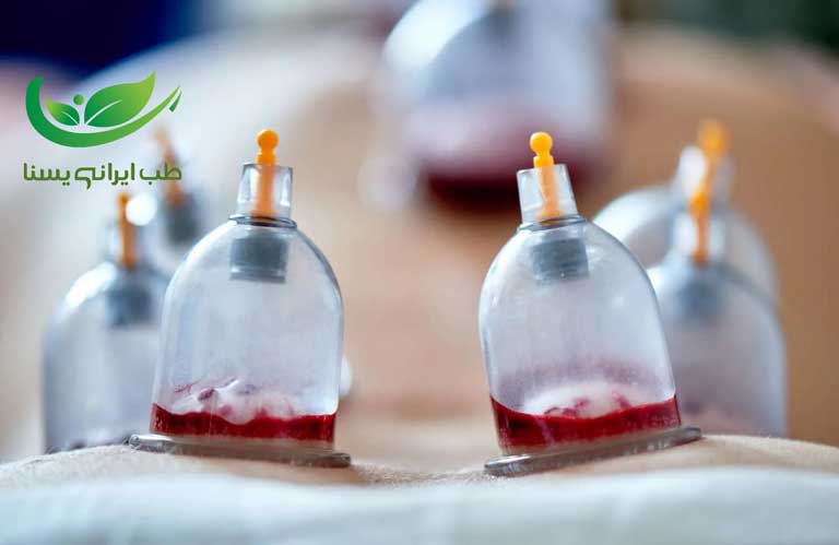 حجامت برای چه افرادی ضرر دارد