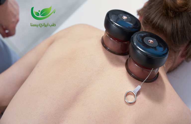 حجامت ماستوئید چیست