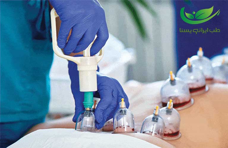 حجامت ساکرال برای بواسیر