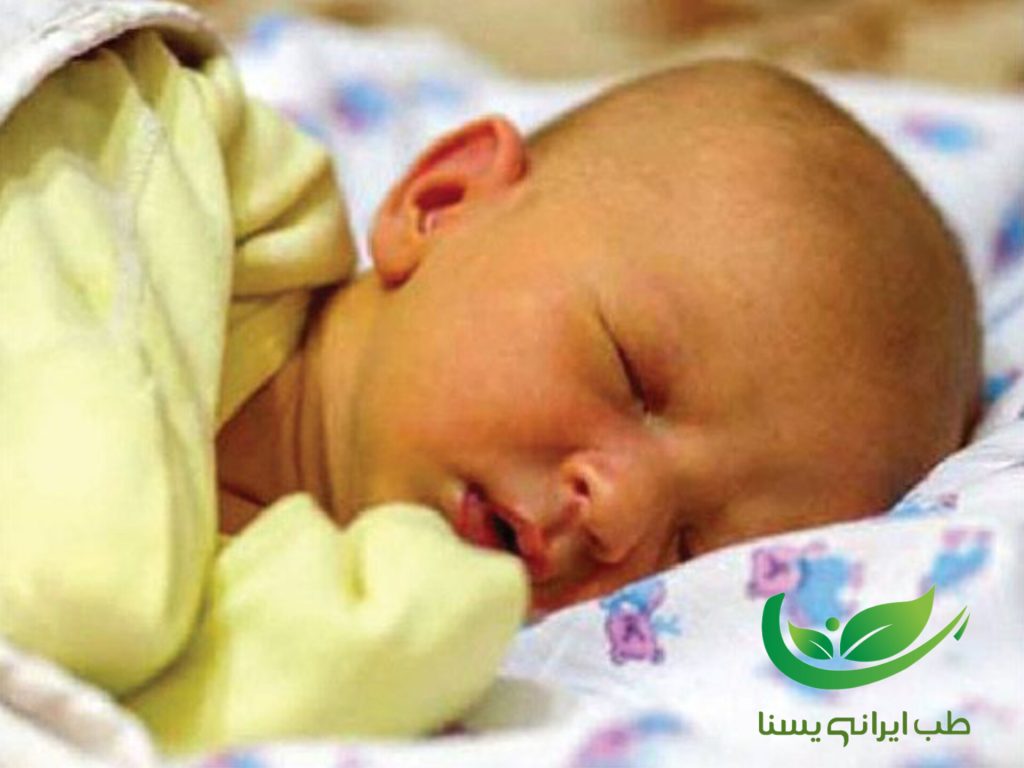 درمان زردی