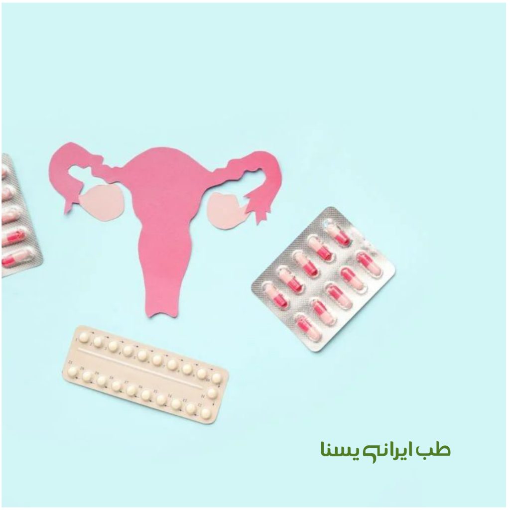 مسکن ها