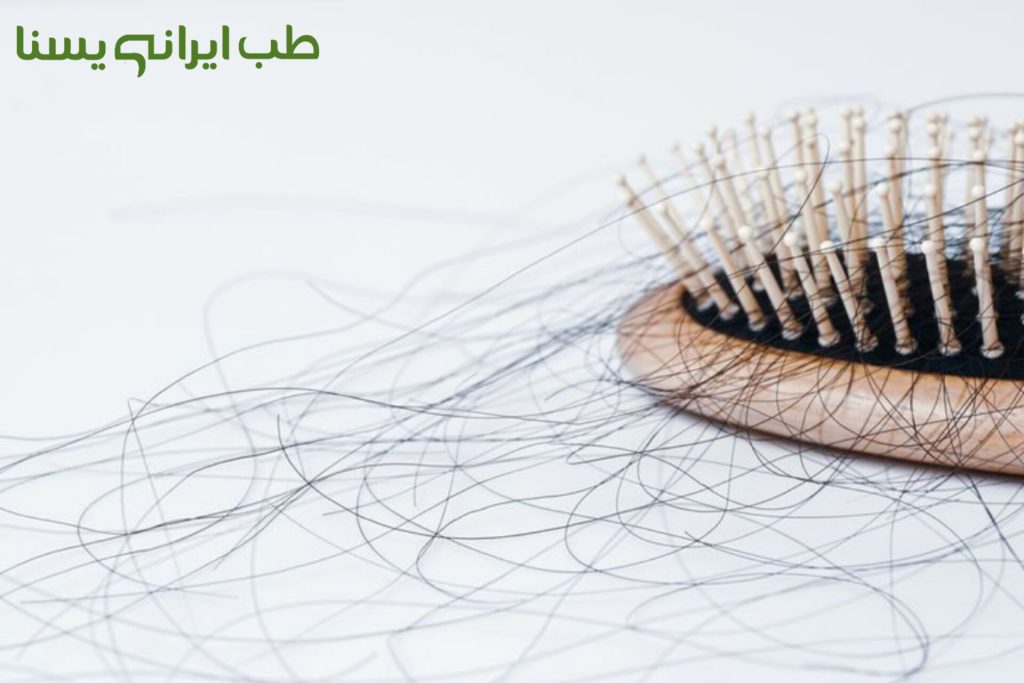 علت ریزش مو