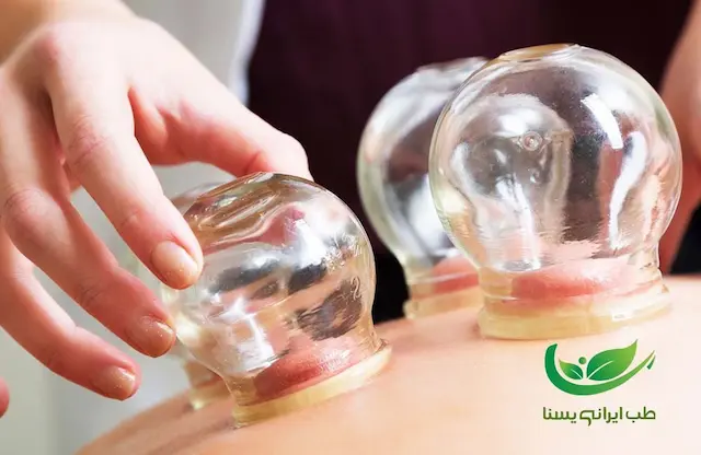 خدمات حجامت