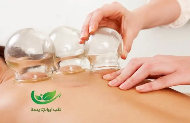 خدمات حجامت