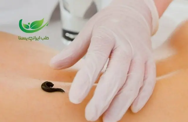 خدمات حجامت